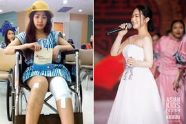 Từng bị tai nạn sân khấu bỏng nặng, Lương Bích Hữu giờ thế nào?