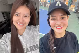 Thùy Anh tự tin khoe sắc sau hơn 1 tháng tai nạn phim trường