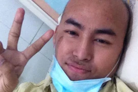 Người mẫu Duy Nhân qua đời sau nhiều ngày hôn mê