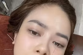 Ca sĩ Dương Hoàng Yến nhập viện cấp cứu vì liệt dây thần kinh số 7