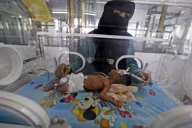 Đất nước Yemen tang tóc điêu tàn trong không kích