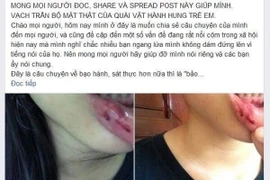 Vụ 'MC truyền hình bị tố bạo hành em vợ': Cơ quan chức năng vào cuộc