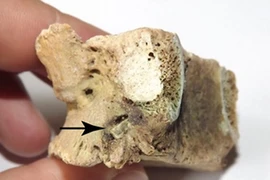 Vết thương lạ trên hài cốt nam chiến binh Thời Đồ sắt