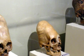 Giải mã sốc về hộp sọ bí ẩn của người ngoài hành tinh