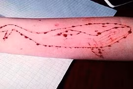 “Trò chơi sinh tử” khiến hàng trăm thanh thiếu niên tự sát