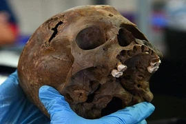 Bí mật kinh hoàng ẩn sau bộ hài cốt trẻ em vừa phát hiện