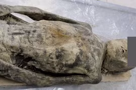 Xem xác ướp thế kỷ 17 bị thoát vị cơ hoành