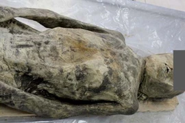 Xem xác ướp thế kỷ 17 bị thoát vị cơ hoành