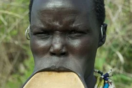 Quái chiêu quàng miệng làm đẹp 