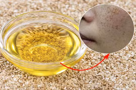 Mách bạn cách chăm sóc da cực kỳ đơn giản, không tốn kém