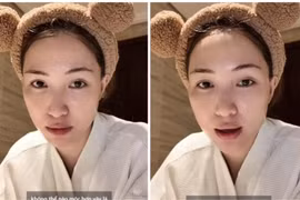 Dính nghi vấn “dao kéo”, Hòa Minzy đăng clip đính chính