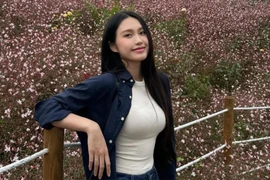 Vợ Đoàn Văn Hậu gặp sự cố ảnh hướng đến gương mặt