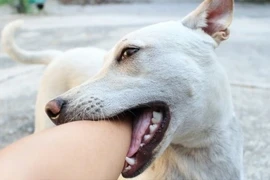 Bé gái 7 tuổi ở Bắc Kạn tử vong nghi bị chó dại cắn