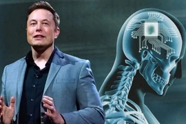 Người thứ 2 được cấy ghép chip não có thể điều khiển bằng suy nghĩ?