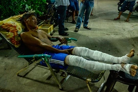Nổ khí gas, hai người bị bỏng nặng