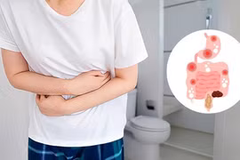 Địa chỉ vàng: Thực phẩm bổ sung hỗ trợ hội chứng ruột kích thích 