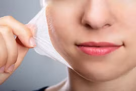 Peel da an toàn bằng AHA