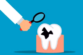 Bật mí "thói quen nhỏ, lợi ích to" giúp ngừa sâu răng hiệu quả