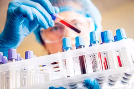 Biến chủng SARS-CoV-2 ở Ấn Độ đã xuất hiện ở Việt Nam