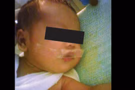 Rúng động y tá dán băng dính cấm bé 5 ngày tuổi khóc