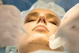 Xu hướng làm nhọn cằm hot nhất hiện nay