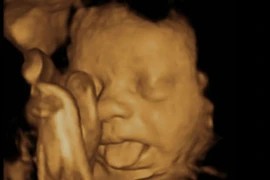 Khoảnh khắc thai nhi siêu cute