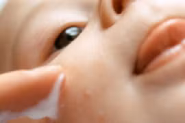 Mẹo dân gian trị vết ngứa do muỗi đốt cho bé