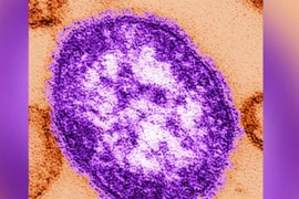 Sắp có thuốc uống chữa khỏi bệnh sởi