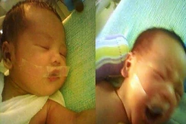 Thắt lòng những em bé bị y tá dán băng dính vào miệng