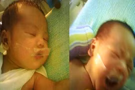 Thắt lòng những em bé bị y tá dán băng dính vào miệng