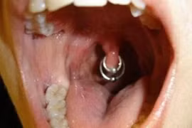 Kiểu xỏ khuyên miệng đau đớn nhất