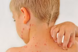 Tác hại không ngờ khi trẻ ăn quá nhiều đồ ngọt