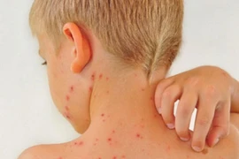 Tác hại không ngờ khi trẻ ăn quá nhiều đồ ngọt