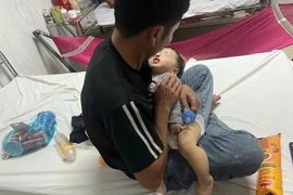 Xác minh vụ việc cháu bé 9 tháng tuổi bị bầm tím 2 má