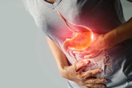 Medispores Biota quảng cáo 'nổ': Công ty Dược Tâm Mỹ An nói gì?