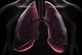  7 sát thủ đáng sợ gây bệnh phổi ít ai ngờ đến