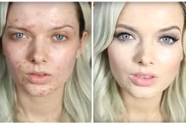 Xem cô gái mặt mụn chi chít trang điểm đẹp như tiên 