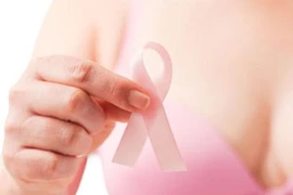 Trường hợp nào không nên hóa trị ung thư vú?