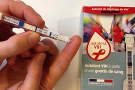 Xét nghiệm HIV tại nhà, có kết quả sau 15 phút