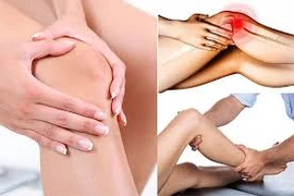 Video: Nguyên nhân, triệu chứng và cách điều trị đau đầu gối