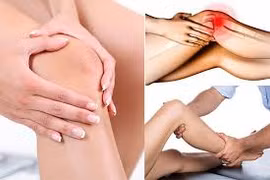 Video: Nguyên nhân, triệu chứng và cách điều trị đau đầu gối