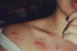 "Vùng cấm hôn", tuyệt đối đừng chạm vào khi "yêu"