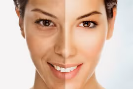 6 thói quen gây lão hóa khiến da nhăn nheo