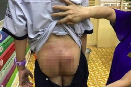 Bé 10 tuổi bị bố, mẹ kế bạo hành: Mẹ được quyền nuôi, sao “ủn” cho bố?