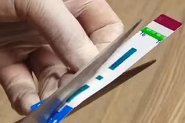 Nhân viên Bệnh viện Xanh Pôn gian dối xét nghiệm: Có thể truy tố hình sự?