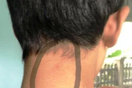 Nhóm phụ huynh tấn công nam sinh lớp 8 THCS Quảng Ninh sẽ bị xử lý thế nào?