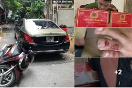 Tài xế Maybach S650 tự xưng là “lái xe Bộ trưởng Bộ Công an” đánh người: CA nói gì?