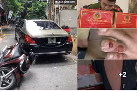 Tài xế Maybach S650 tự xưng là “lái xe Bộ trưởng Bộ Công an” đánh người: CA nói gì?