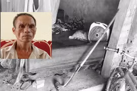 Bé trai bị bác chém lìa tay ở Bắc Giang: Nguyên nhân do bệnh trầm cảm?