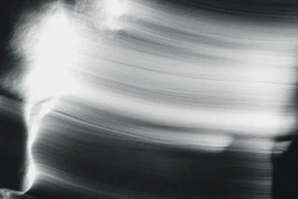 Trải nghiệm cận tử và tín hiệu não sau khi tử vong